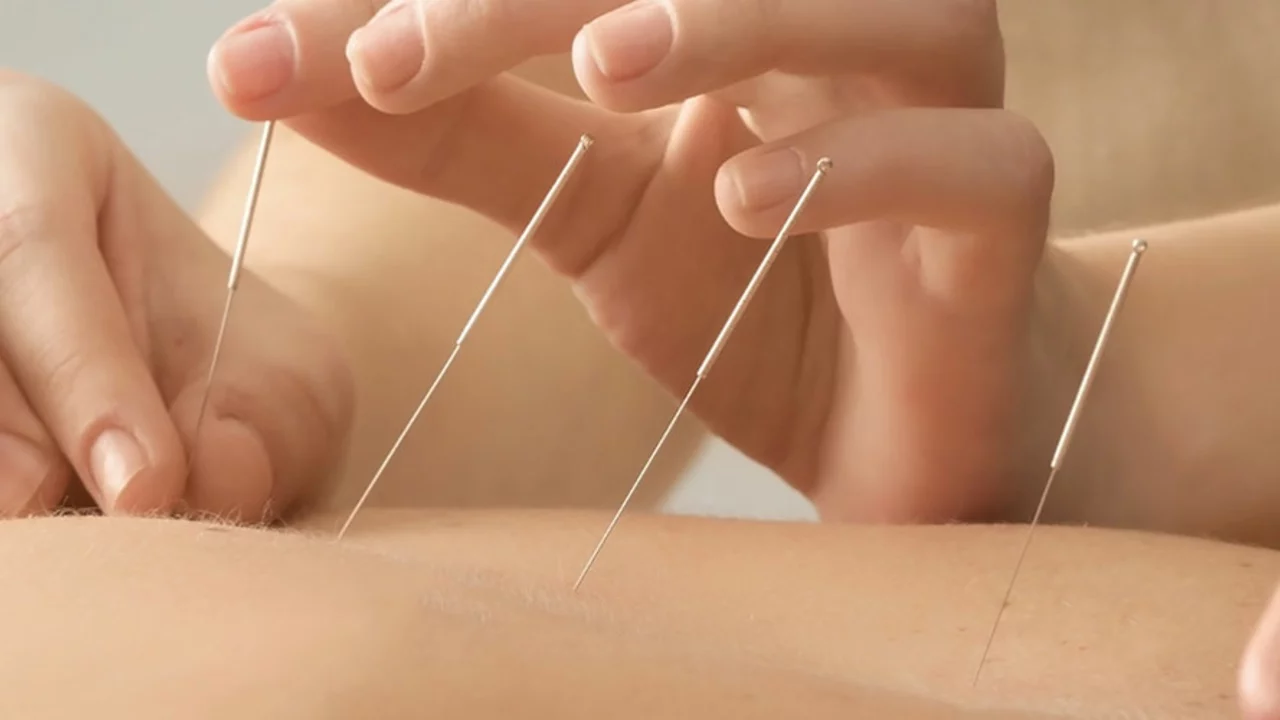 The Benefits of Acupuncture for Cancer Patients