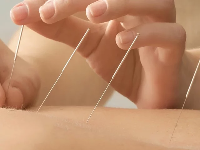 The Benefits of Acupuncture for Cancer Patients