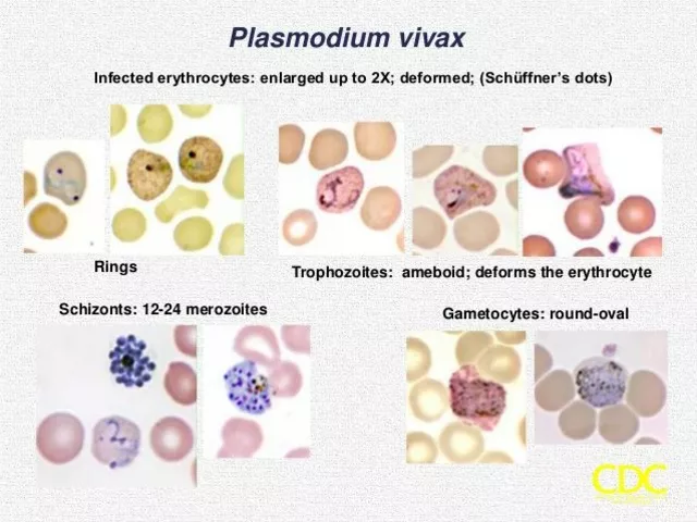 The role of Primaquine in preventing relapse in Plasmodium vivax malaria
